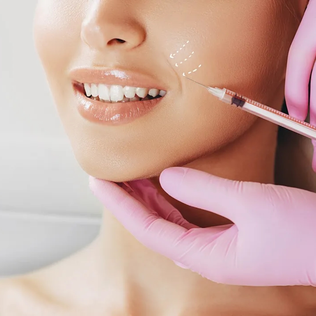 XERF skin tightening at Gen Aesthetics